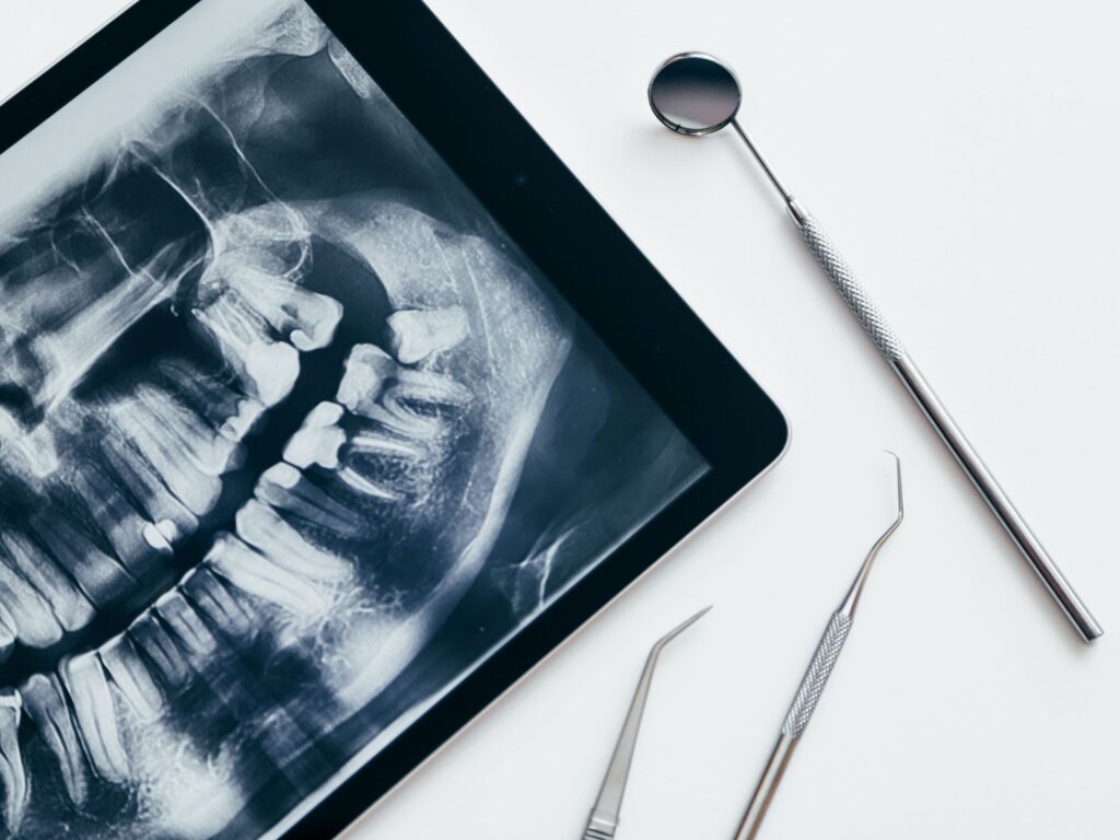 Radiologie dentaire Cabinet Dentaire de la Lone - dentiste - Boulbon